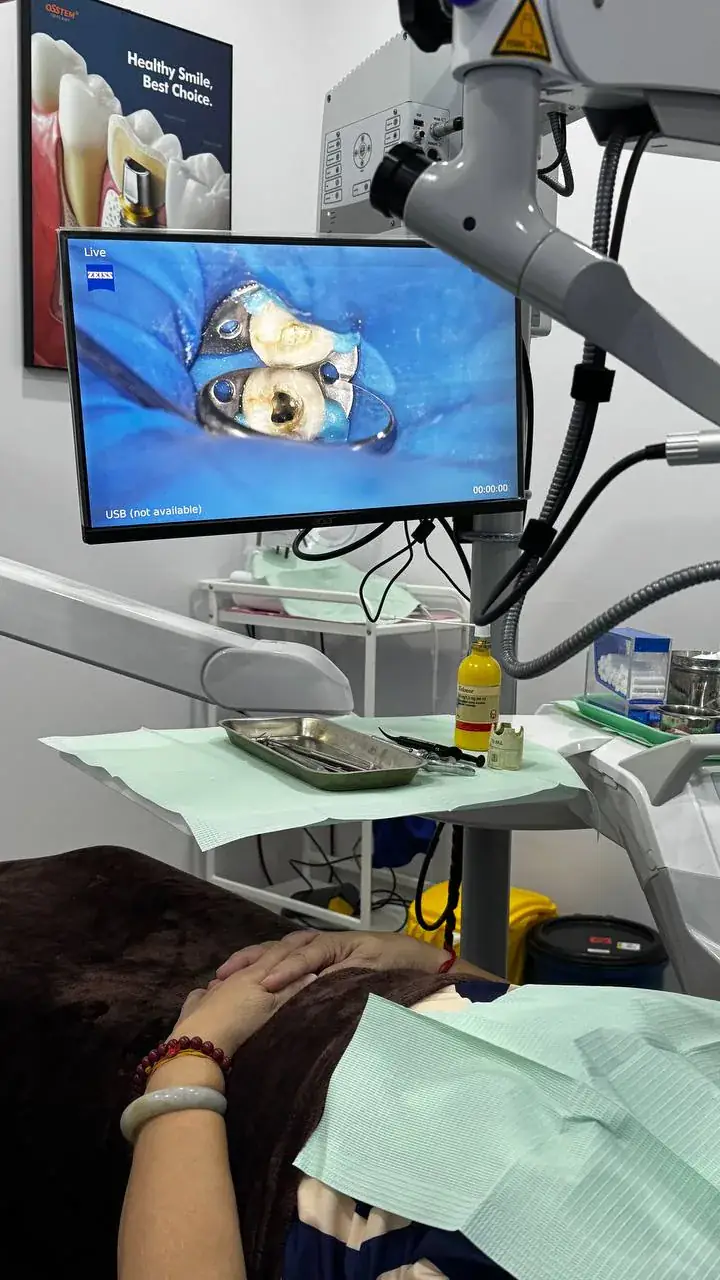 Our endodontist carrying out root canal treatment under a dental microscope in Bukit Jalil, saving an infected tooth from extraction