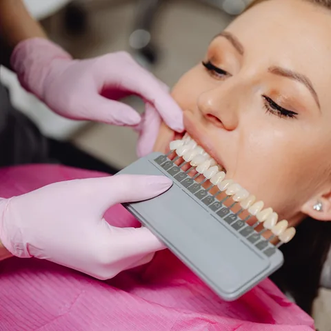Dentist holding a shade guide against a patient's teeth before whitening